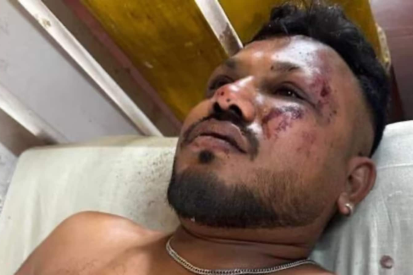 Ahmedabad Plane Crash: A man escaped alive from a plane made of fire, how did this charisma? – Vishwas kumar ramesh escaped alive from ahmedabad plane crash how did this miracle happen