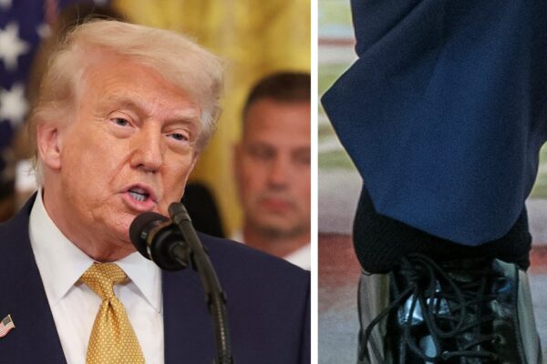 Donald Trump Health News: Donald Trump’s Health White House confirms Chronic Venus inspiration